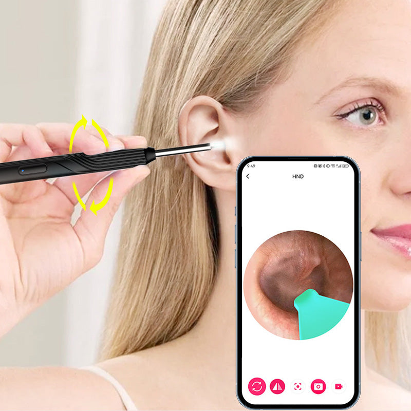 Dispositif de Nettoyage des Oreilles avec Caméra HD