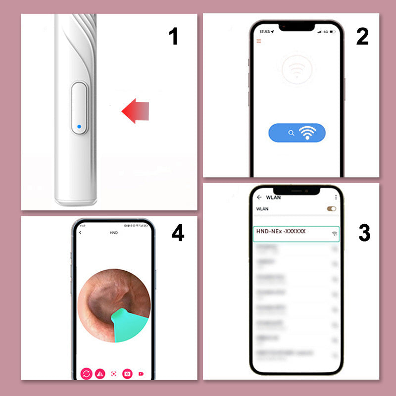 Dispositif de Nettoyage des Oreilles avec Caméra HD